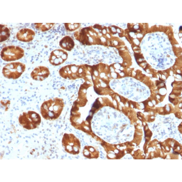 Immunohistochemistry - Anti-Estrogen Sulfotransferase Antibody [CPTC-SULT1E1-1] (A250068) - Antibodies.com