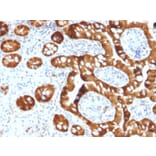 Immunohistochemistry - Anti-Estrogen Sulfotransferase Antibody [CPTC-SULT1E1-1] (A250068) - Antibodies.com