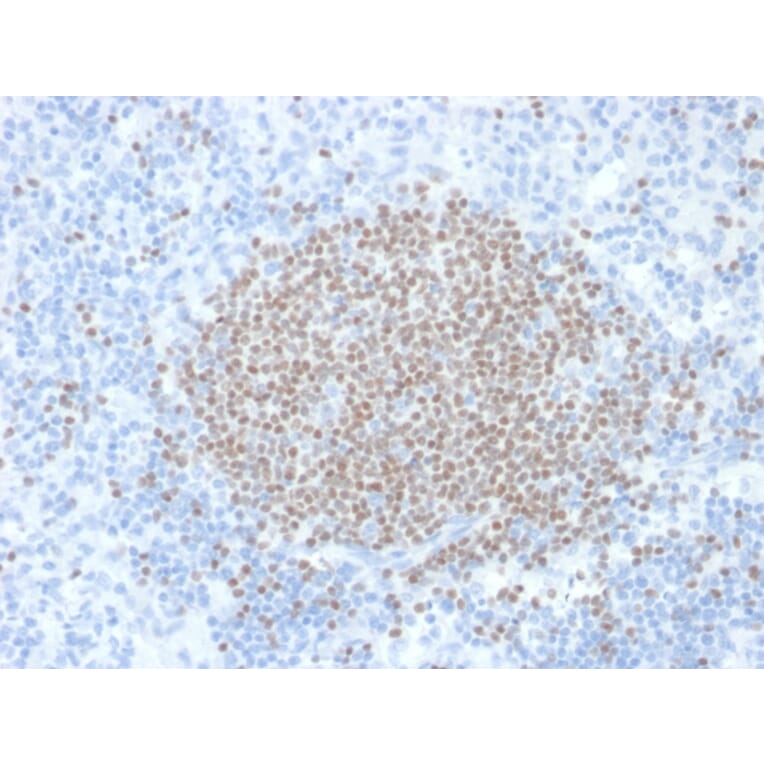 Immunohistochemistry - Anti-Estrogen Sulfotransferase Antibody [CPTC-SULT1E1-1] (A250067) - Antibodies.com