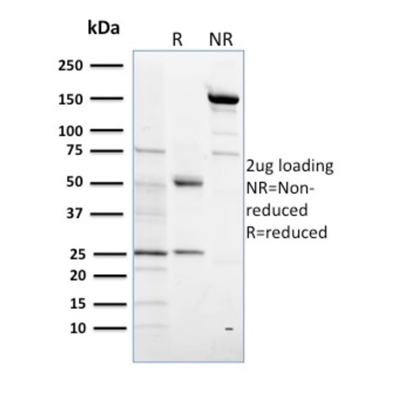 SDS-PAGE - Anti-Estrogen Sulfotransferase Antibody [CPTC-SULT1E1-1] (A250068) - Antibodies.com