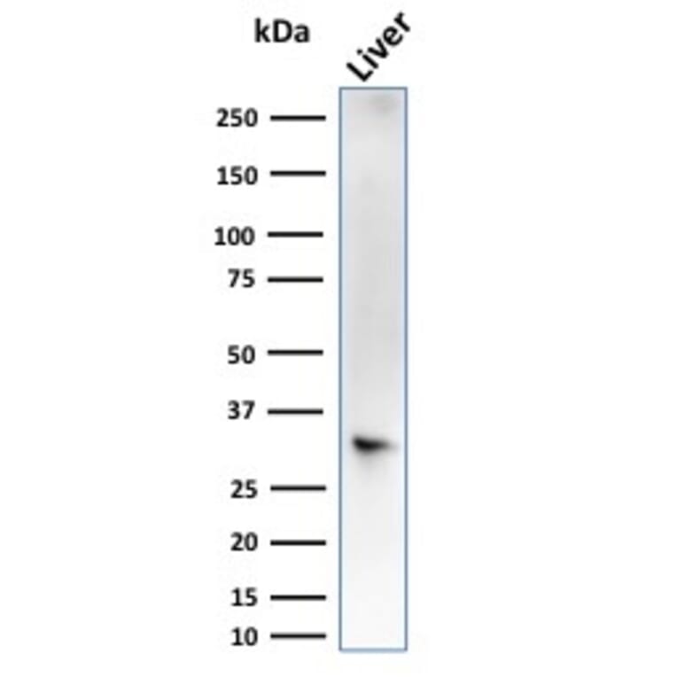 Western Blot - Anti-Estrogen Sulfotransferase Antibody [CPTC-SULT1E1-1] (A250068) - Antibodies.com