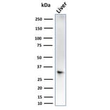 Western Blot - Anti-Estrogen Sulfotransferase Antibody [CPTC-SULT1E1-1] (A250068) - Antibodies.com