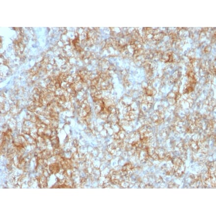 Immunohistochemistry - Anti-CD147 Antibody [8D6] (A250068) - Antibodies.com