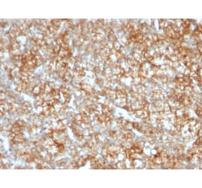 Immunohistochemistry - Anti-CD147 Antibody [BSG/963] (A250070) - Antibodies.com