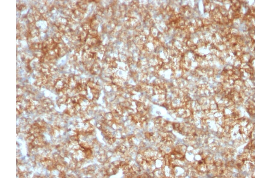 Immunohistochemistry - Anti-CD147 Antibody [BSG/963] (A250070) - Antibodies.com