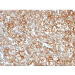 Immunohistochemistry - Anti-CD147 Antibody [BSG/963] (A250070) - Antibodies.com