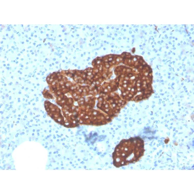 Immunohistochemistry - Anti-Synaptophysin Antibody [SYP/3551] (A250071) - Antibodies.com