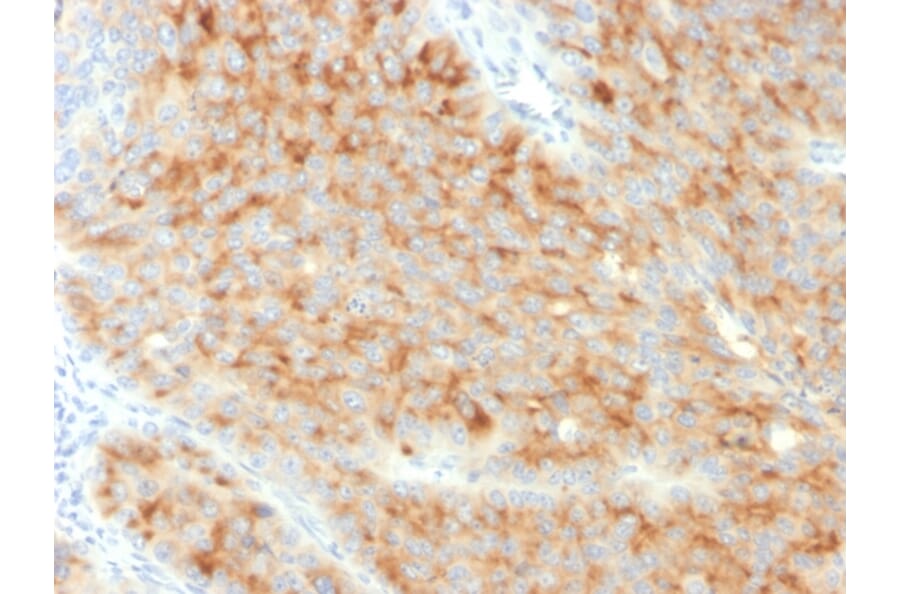 Immunohistochemistry - Anti-Synaptophysin Antibody [SYP/3551] (A250071) - Antibodies.com
