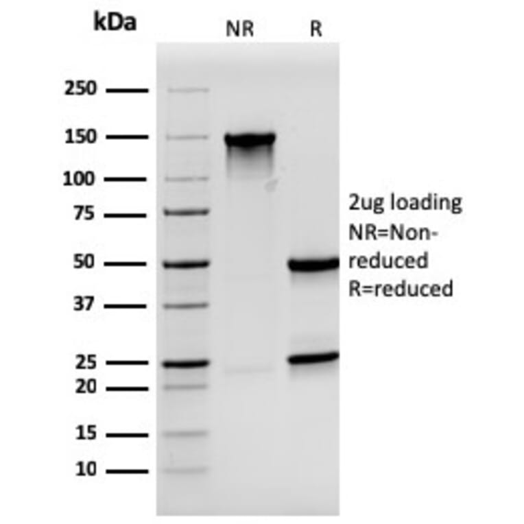SDS-PAGE - Anti-Synaptophysin Antibody [SYP/3551] (A250071) - Antibodies.com