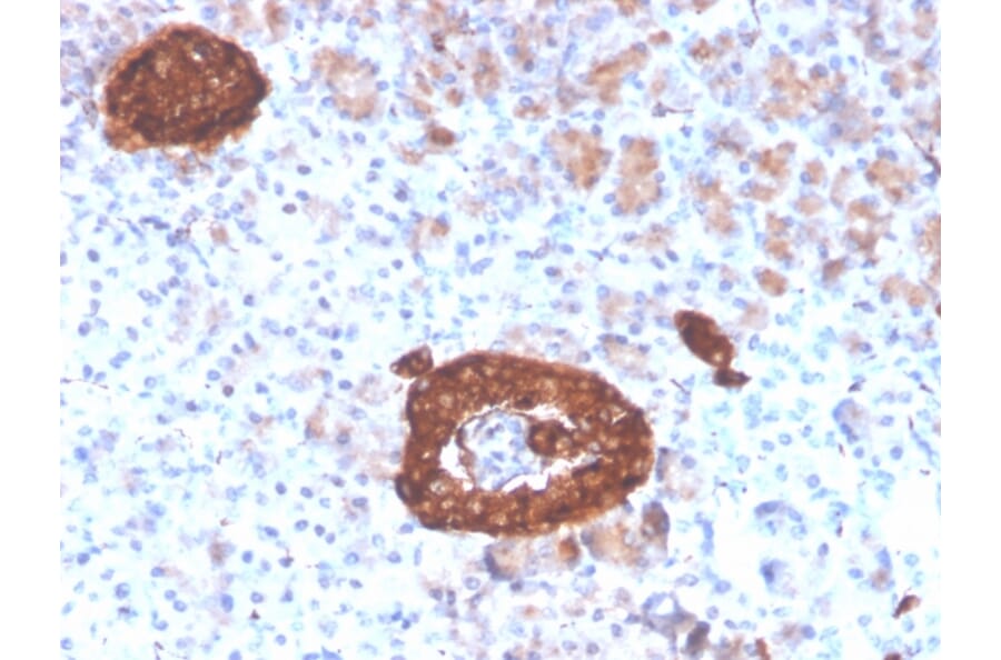 Immunohistochemistry - Anti-Synaptophysin Antibody [rSYP/4654] (A250071) - Antibodies.com
