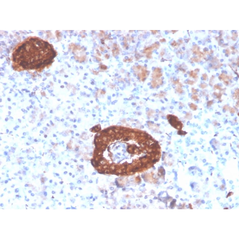 Immunohistochemistry - Anti-Synaptophysin Antibody [rSYP/4654] (A250071) - Antibodies.com