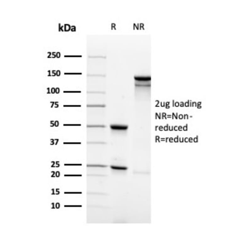 SDS-PAGE - Anti-Synaptophysin Antibody [rSYP/4654] (A250072) - Antibodies.com