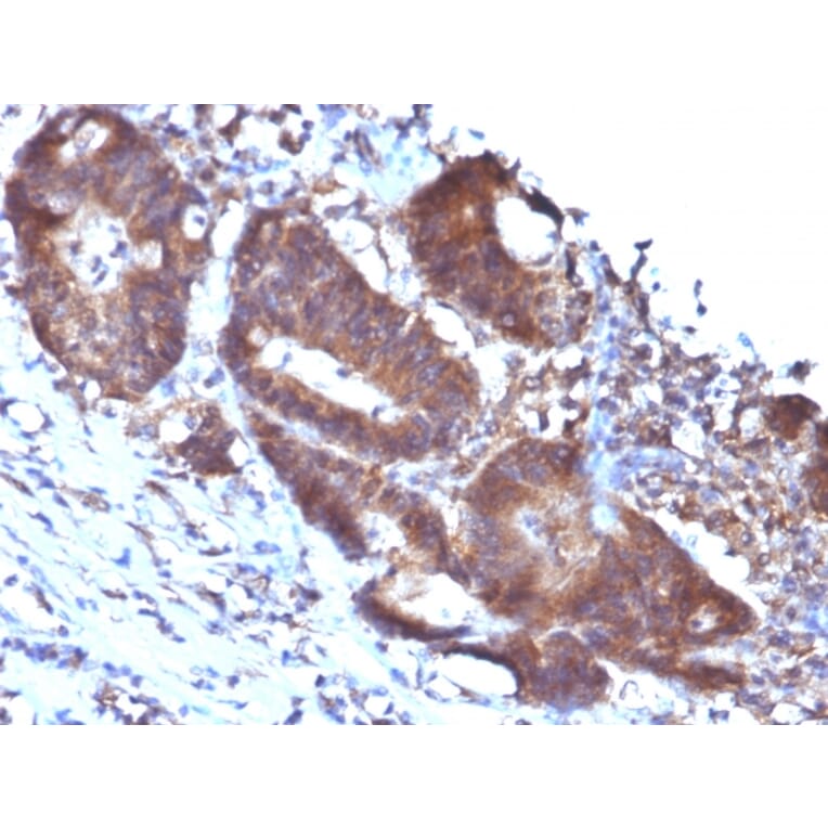Immunohistochemistry - Anti-Transgelin Antibody [TAGLN/247] (A250074) - Antibodies.com