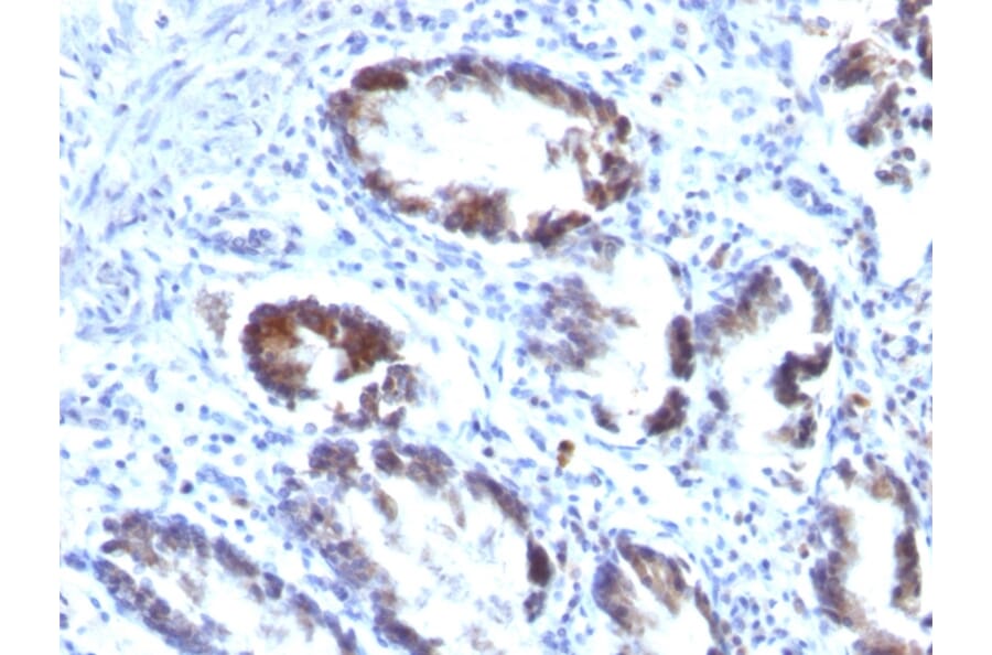 Immunohistochemistry - Anti-Transgelin Antibody [TAGLN/247] (A250073) - Antibodies.com