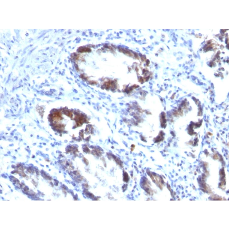 Immunohistochemistry - Anti-Transgelin Antibody [TAGLN/247] (A250073) - Antibodies.com