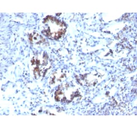 Immunohistochemistry - Anti-Transgelin Antibody [SPM606] (A250074) - Antibodies.com