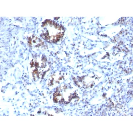 Immunohistochemistry - Anti-Transgelin Antibody [SPM606] (A250074) - Antibodies.com