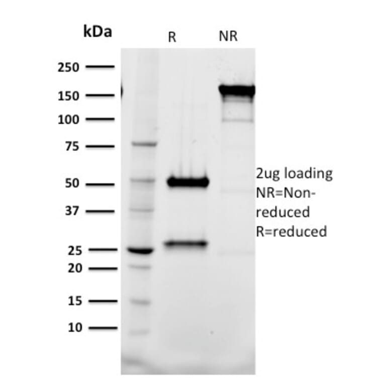 SDS-PAGE - Anti-Tal1 Antibody [BTL73] (A250076) - Antibodies.com