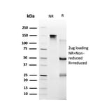 SDS-PAGE - Anti-TRBP Antibody [PCRP-TARBP2-1E5] (A250079) - Antibodies.com