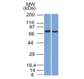 Western Blot - Anti-TCF4 Antibody [TCF4/1705] (A250080) - Antibodies.com