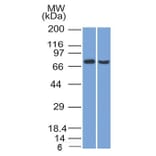 Western Blot - Anti-TCF4 Antibody [TCF4/1705] (A250080) - Antibodies.com