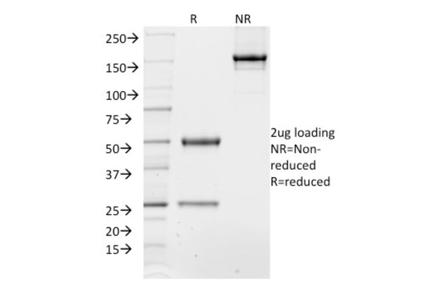 SDS-PAGE - Anti-TCF4 Antibody [TCF4/1705] (A250080) - Antibodies.com
