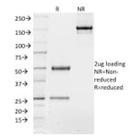 SDS-PAGE - Anti-TCF4 Antibody [TCF4/1705] (A250080) - Antibodies.com