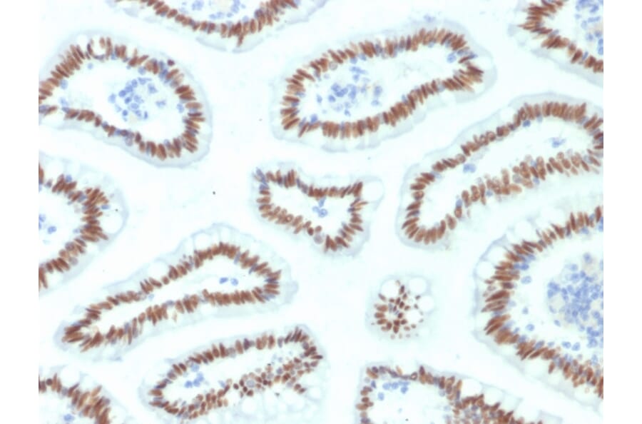 Immunohistochemistry - Anti-HNF1 alpha Antibody [HNF1A/2087] (A250081) - Antibodies.com