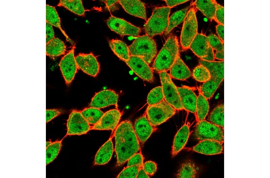 Immunofluorescence - Anti-MLX Antibody [PCRP-MLX-1G8] (A250082) - Antibodies.com