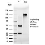 SDS-PAGE - Anti-MLX Antibody [PCRP-MLX-1G8] (A250082) - Antibodies.com