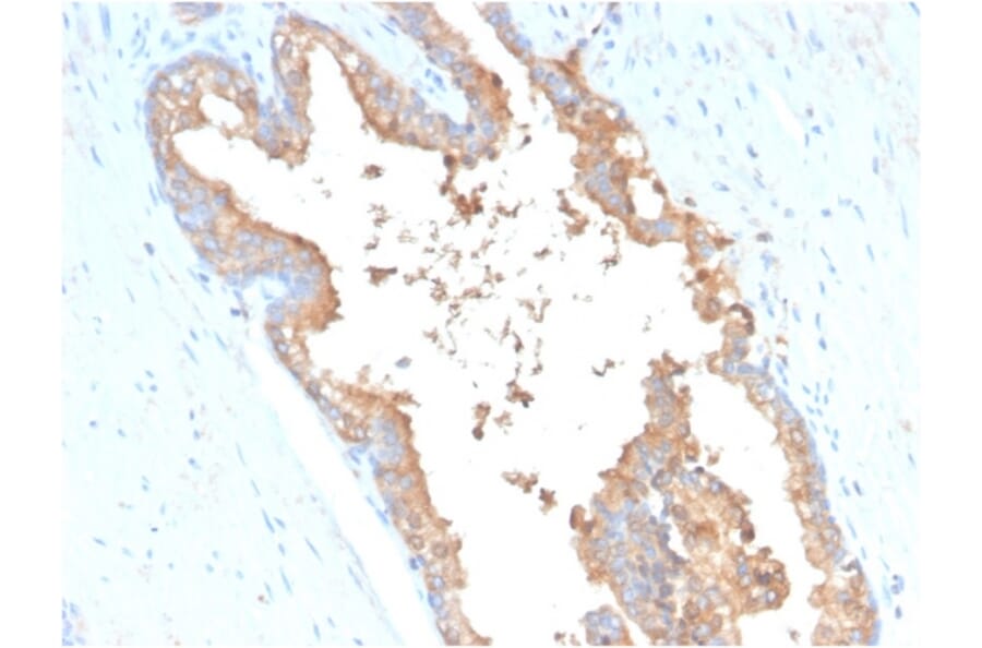 Immunohistochemistry - Anti-Transferrin Antibody [TF/3001] (A250083) - Antibodies.com