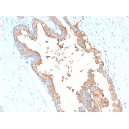 Immunohistochemistry - Anti-Transferrin Antibody [TF/3001] (A250083) - Antibodies.com