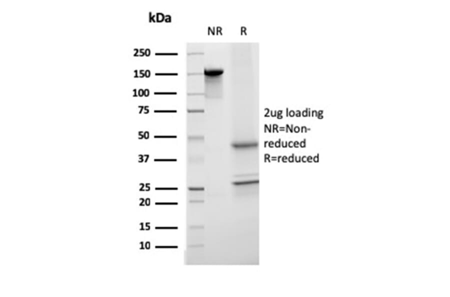 SDS-PAGE - Anti-Transferrin Antibody [TF/3001] (A250083) - Antibodies.com