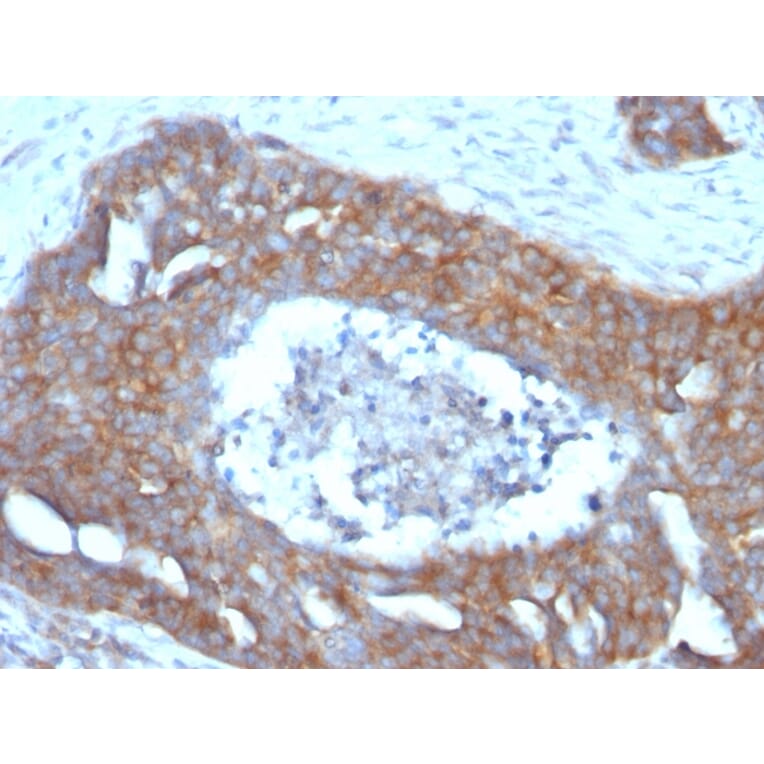 Immunohistochemistry - Anti-Estrogen Inducible Protein pS4 Antibody [GE2] (A250084) - Antibodies.com