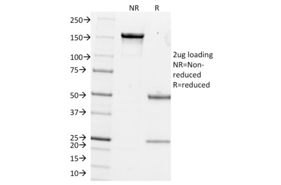 SDS-PAGE - Anti-Estrogen Inducible Protein pS4 Antibody [GE2] (A250084) - Antibodies.com