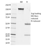 SDS-PAGE - Anti-Estrogen Inducible Protein pS4 Antibody [GE2] (A250084) - Antibodies.com