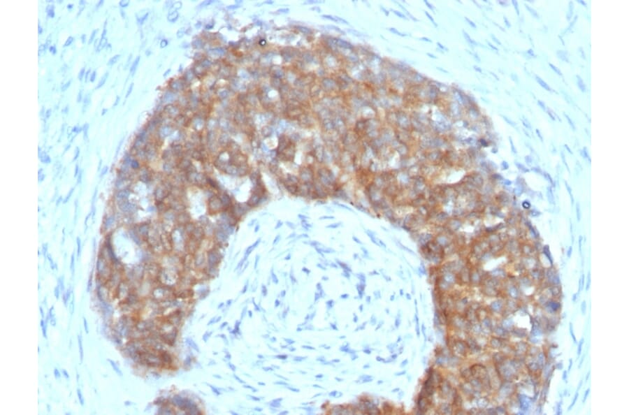 Immunohistochemistry - Anti-Estrogen Inducible Protein pS5 Antibody [SPM313] (A250085) - Antibodies.com