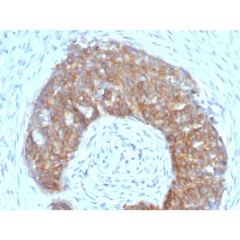 Immunohistochemistry - Anti-Estrogen Inducible Protein pS5 Antibody [SPM313] (A250085) - Antibodies.com