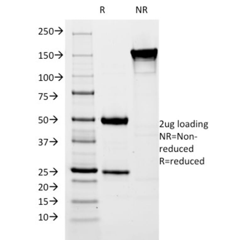 SDS-PAGE - Anti-Estrogen Inducible Protein pS5 Antibody [SPM313] (A250086) - Antibodies.com