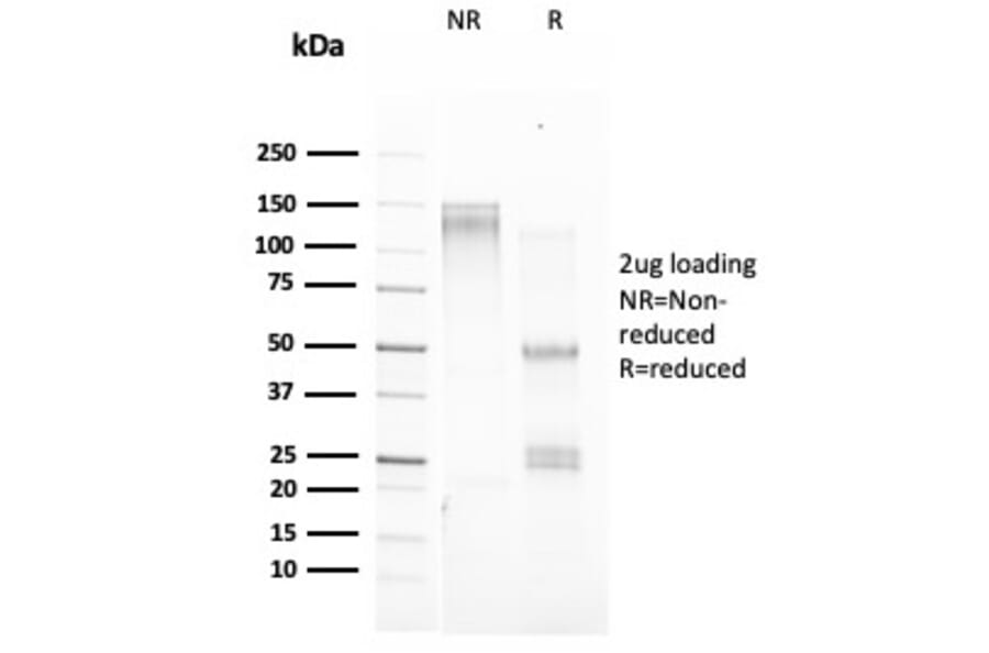 SDS-PAGE - Anti-Estrogen Inducible Protein pS2 Antibody [TFF1/2133] (A250088) - Antibodies.com