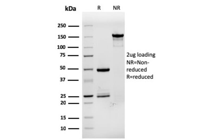 SDS-PAGE - Anti-Estrogen Inducible Protein pS8 Antibody [rTFF1/1091] (A253270) - Antibodies.com