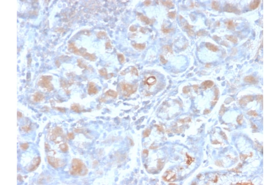 Immunohistochemistry - Anti-Estrogen Inducible Protein pS6 Antibody [TFF1/2969R] (A250089) - Antibodies.com
