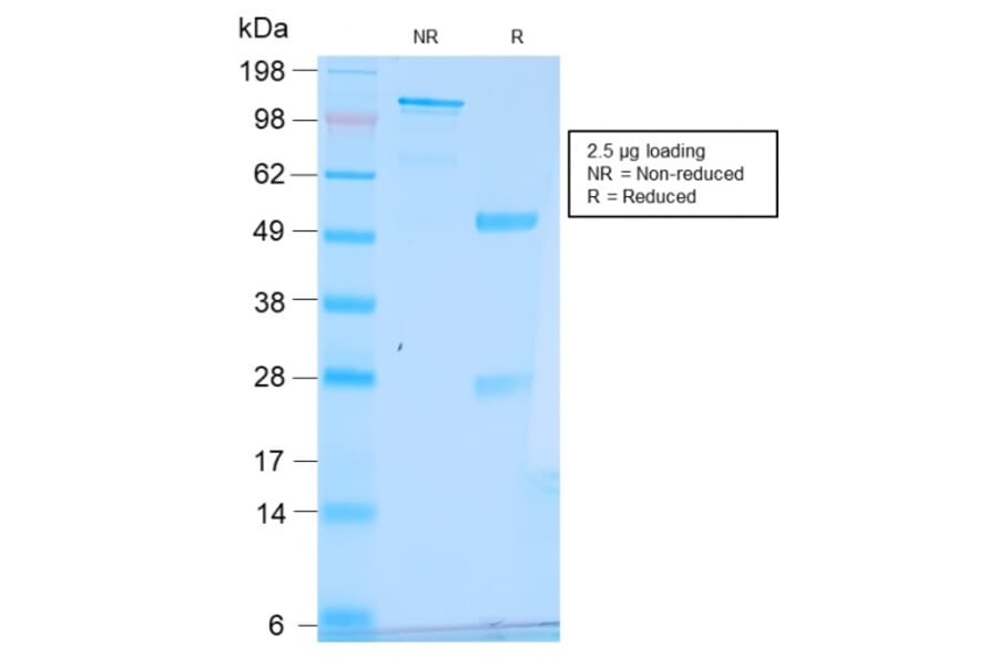 SDS-PAGE - Anti-Estrogen Inducible Protein pS6 Antibody [TFF1/2969R] (A250090) - Antibodies.com