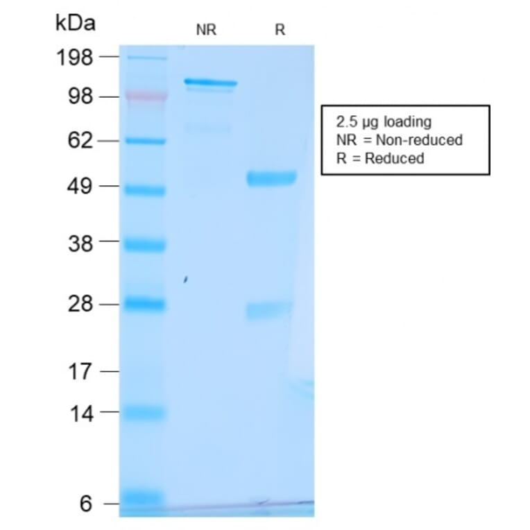 SDS-PAGE - Anti-Estrogen Inducible Protein pS6 Antibody [TFF1/2969R] (A250090) - Antibodies.com