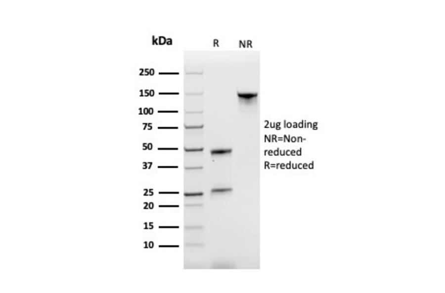 SDS-PAGE - Anti-Transferrin Receptor Antibody [TFRC/3630] (A250091) - Antibodies.com