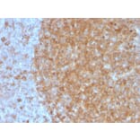 Immunohistochemistry - Anti-Transferrin Receptor Antibody [TFRC/3630] (A250091) - Antibodies.com