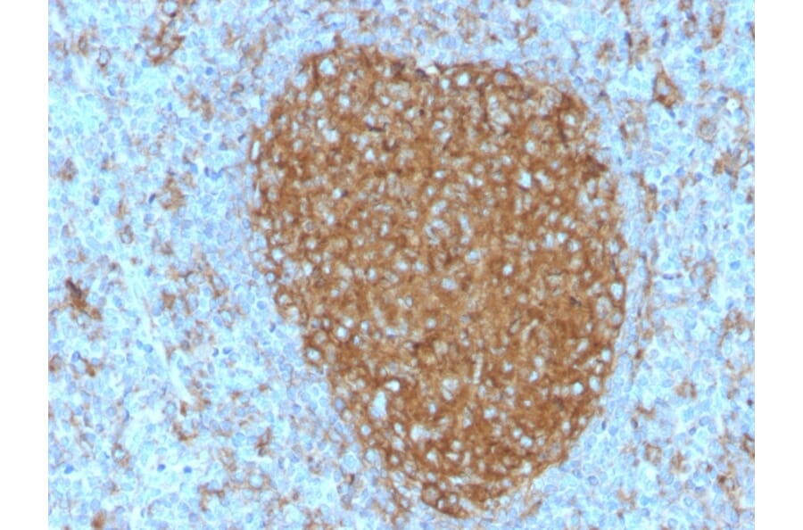 Immunohistochemistry - Anti-Transferrin Receptor Antibody [TFRC/3630] (A250091) - Antibodies.com
