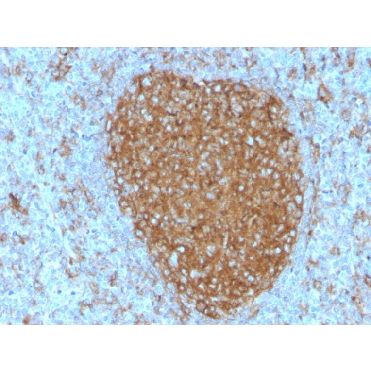 Immunohistochemistry - Anti-Transferrin Receptor Antibody [TFRC/3630] (A250091) - Antibodies.com