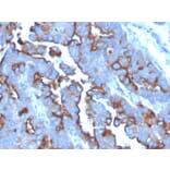 Immunohistochemistry - Anti-Transferrin Receptor Antibody [TFRC/3630] (A250090) - Antibodies.com