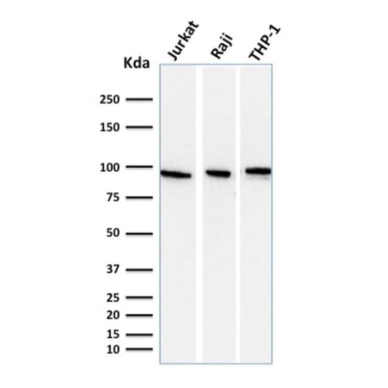 Western Blot - Anti-Transferrin Receptor Antibody [DF1513] (A250092) - Antibodies.com